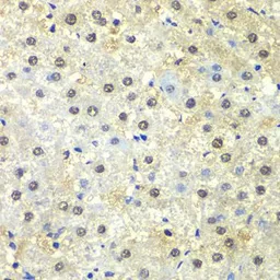 Anti-PSMD13 antibody used in IHC (Paraffin sections) (IHC-P). GTX33438