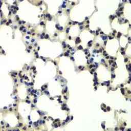 Anti-PSMD13 antibody used in IHC (Paraffin sections) (IHC-P). GTX33438