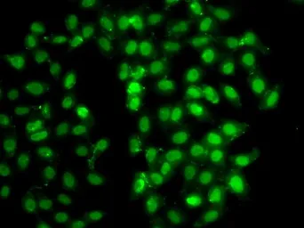 Anti-PSMD8 antibody used in Immunocytochemistry/ Immunofluorescence (ICC/IF). GTX33440