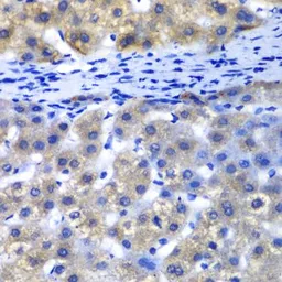 Anti-PSMD8 antibody used in IHC (Paraffin sections) (IHC-P). GTX33440