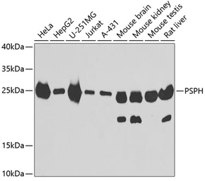 Anti-PSPH antibody used in Western Blot (WB). GTX33442