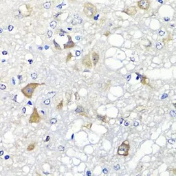 Anti-PSPH antibody used in IHC (Paraffin sections) (IHC-P). GTX33442
