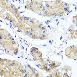 Anti-PSTPIP1 antibody used in IHC (Paraffin sections) (IHC-P). GTX33443