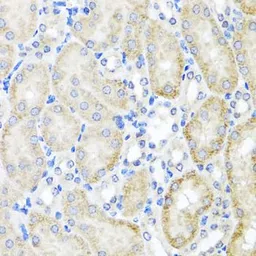 Anti-PSTPIP1 antibody used in IHC (Paraffin sections) (IHC-P). GTX33443