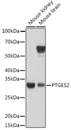 Anti-PTGES2 antibody used in Western Blot (WB). GTX33444
