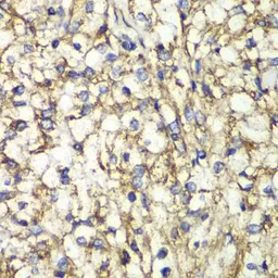 Anti-PTGES2 antibody used in IHC (Paraffin sections) (IHC-P). GTX33444