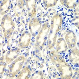 Anti-PTGES2 antibody used in IHC (Paraffin sections) (IHC-P). GTX33444