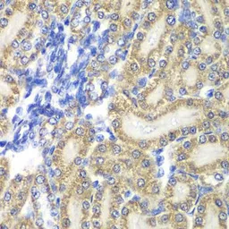 Anti-PTGES2 antibody used in IHC (Paraffin sections) (IHC-P). GTX33444