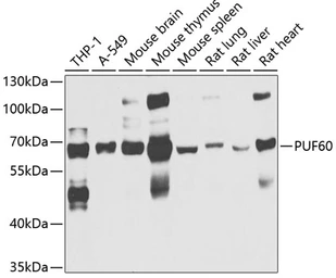 Anti-PUF60 antibody used in Western Blot (WB). GTX33446