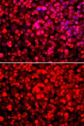 Anti-PUF60 antibody used in Immunocytochemistry/ Immunofluorescence (ICC/IF). GTX33446
