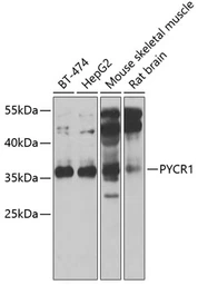 Anti-PYCR1 antibody used in Western Blot (WB). GTX33447