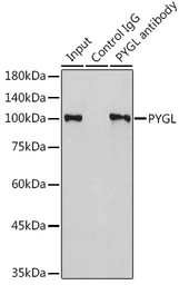 Anti-PYGL antibody used in Immunoprecipitation (IP). GTX33448