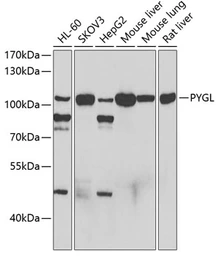 Anti-PYGL antibody used in Western Blot (WB). GTX33448