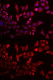 Anti-PYGL antibody used in Immunocytochemistry/ Immunofluorescence (ICC/IF). GTX33448