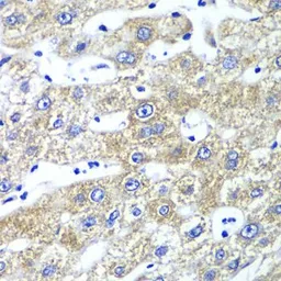 Anti-QARS antibody used in IHC (Paraffin sections) (IHC-P). GTX33449
