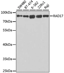 Anti-Rad17 antibody used in Western Blot (WB). GTX33453