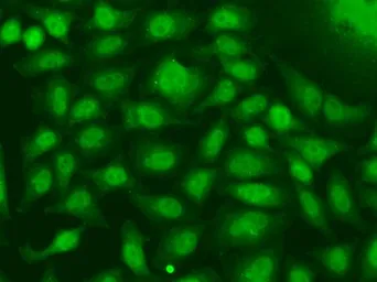 Anti-Rad17 antibody used in Immunocytochemistry/ Immunofluorescence (ICC/IF). GTX33453