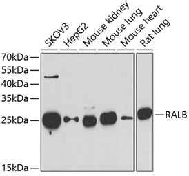 Anti-RALB antibody used in Western Blot (WB). GTX33457