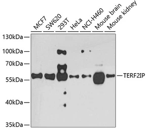 Anti-RAP1 antibody used in Western Blot (WB). GTX33458
