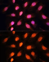 Anti-RAP1 antibody used in Immunocytochemistry/ Immunofluorescence (ICC/IF). GTX33458