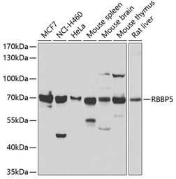 Anti-RBBP5 antibody used in Western Blot (WB). GTX33461