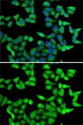 Anti-RBBP5 antibody used in Immunocytochemistry/ Immunofluorescence (ICC/IF). GTX33461