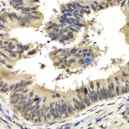 Anti-RBBP5 antibody used in IHC (Paraffin sections) (IHC-P). GTX33461
