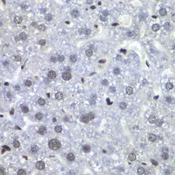 Anti-RBBP5 antibody used in IHC (Paraffin sections) (IHC-P). GTX33461