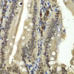 Anti-RBBP5 antibody used in IHC (Paraffin sections) (IHC-P). GTX33461