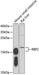 Anti-RBP2 antibody used in Western Blot (WB). GTX33462