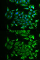 Anti-RBP2 antibody used in Immunocytochemistry/ Immunofluorescence (ICC/IF). GTX33462