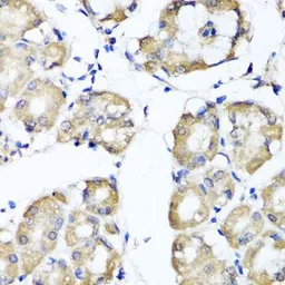Anti-RBP2 antibody used in IHC (Paraffin sections) (IHC-P). GTX33462