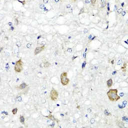 Anti-RBP2 antibody used in IHC (Paraffin sections) (IHC-P). GTX33462