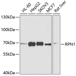 Anti-Ribophorin I antibody used in Western Blot (WB). GTX33466