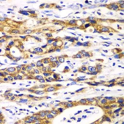 Anti-Ribophorin I antibody used in IHC (Paraffin sections) (IHC-P). GTX33466