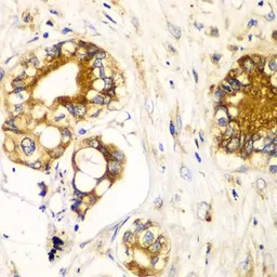 Anti-Ribophorin I antibody used in IHC (Paraffin sections) (IHC-P). GTX33466