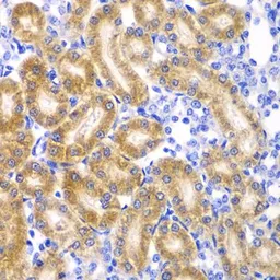Anti-Ribophorin I antibody used in IHC (Paraffin sections) (IHC-P). GTX33466