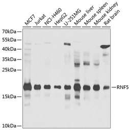 Anti-RNF5 antibody used in Western Blot (WB). GTX33468