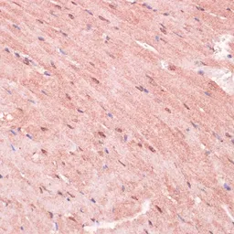 Anti-RNF5 antibody used in IHC (Paraffin sections) (IHC-P). GTX33468
