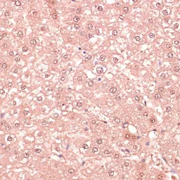 Anti-RNF5 antibody used in IHC (Paraffin sections) (IHC-P). GTX33468