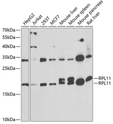 Anti-RPL11 antibody used in Western Blot (WB). GTX33471