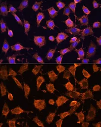 Anti-RPL11 antibody used in Immunocytochemistry/ Immunofluorescence (ICC/IF). GTX33471