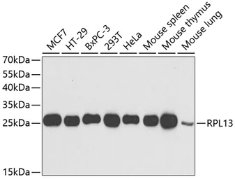 Anti-RPL13 antibody used in Western Blot (WB). GTX33472