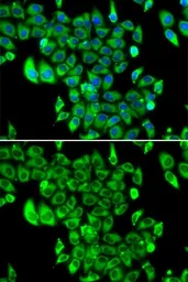 Anti-RPL13 antibody used in Immunocytochemistry/ Immunofluorescence (ICC/IF). GTX33472