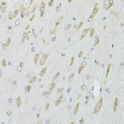 Anti-RPL13 antibody used in IHC (Paraffin sections) (IHC-P). GTX33472