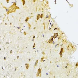 Anti-RPL13 antibody used in IHC (Paraffin sections) (IHC-P). GTX33472
