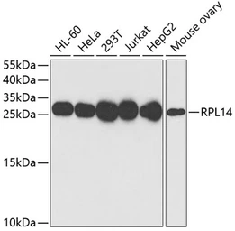 Anti-RPL14 antibody used in Western Blot (WB). GTX33473