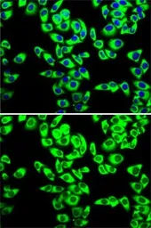 Anti-RPL14 antibody used in Immunocytochemistry/ Immunofluorescence (ICC/IF). GTX33473