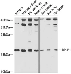 Anti-RPLP1 antibody used in Western Blot (WB). GTX33474