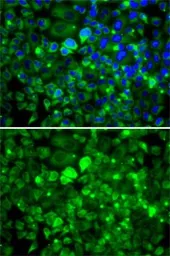 Anti-RPLP1 antibody used in Immunocytochemistry/ Immunofluorescence (ICC/IF). GTX33474